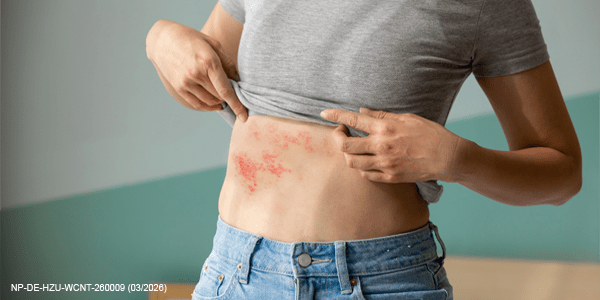 Neu: WebCompactium „Herpes zoster“